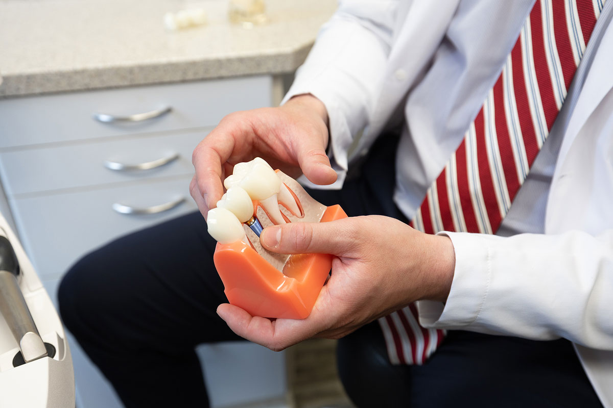 dental implants offered at Brentwood Dental Excellence