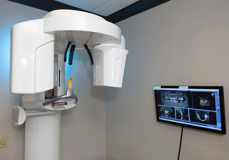 3D digital X-rays used at Brentwood Dental Excellence